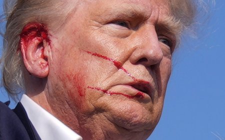 Democrats and the media brought Trump Derangement Syndrome to a fever pitch. Now it's drawn blood