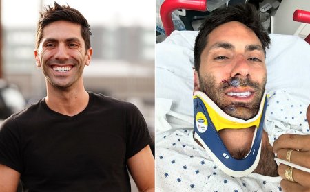 ‘Catfish’ host Nev Schulman ‘lucky to be here,’ revealing he broke his neck in bike accident