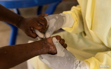 WHO Says Droplets A Minor Route Of Mpox Spread. What We Know So Far