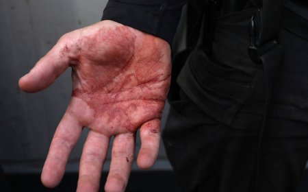 Advocates demand justice after US protester killed in Israeli gunfire