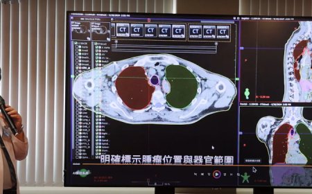 啟用3年累計5,000多個實例，臺中榮總用AI精準圈出放射治療範圍、提高器官保護力