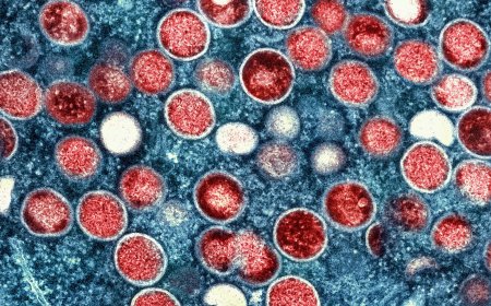 India records first suspected mpox case, male patient in isolation