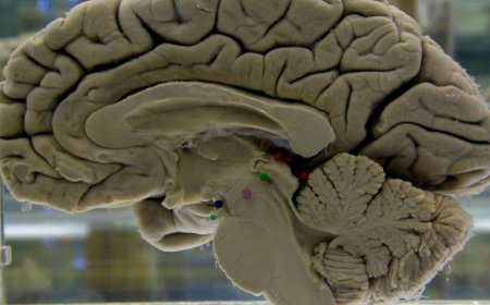 Scans show reorganization of brain during pregnancy